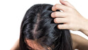 Cute grassa e capelli unti: cause e rimedi